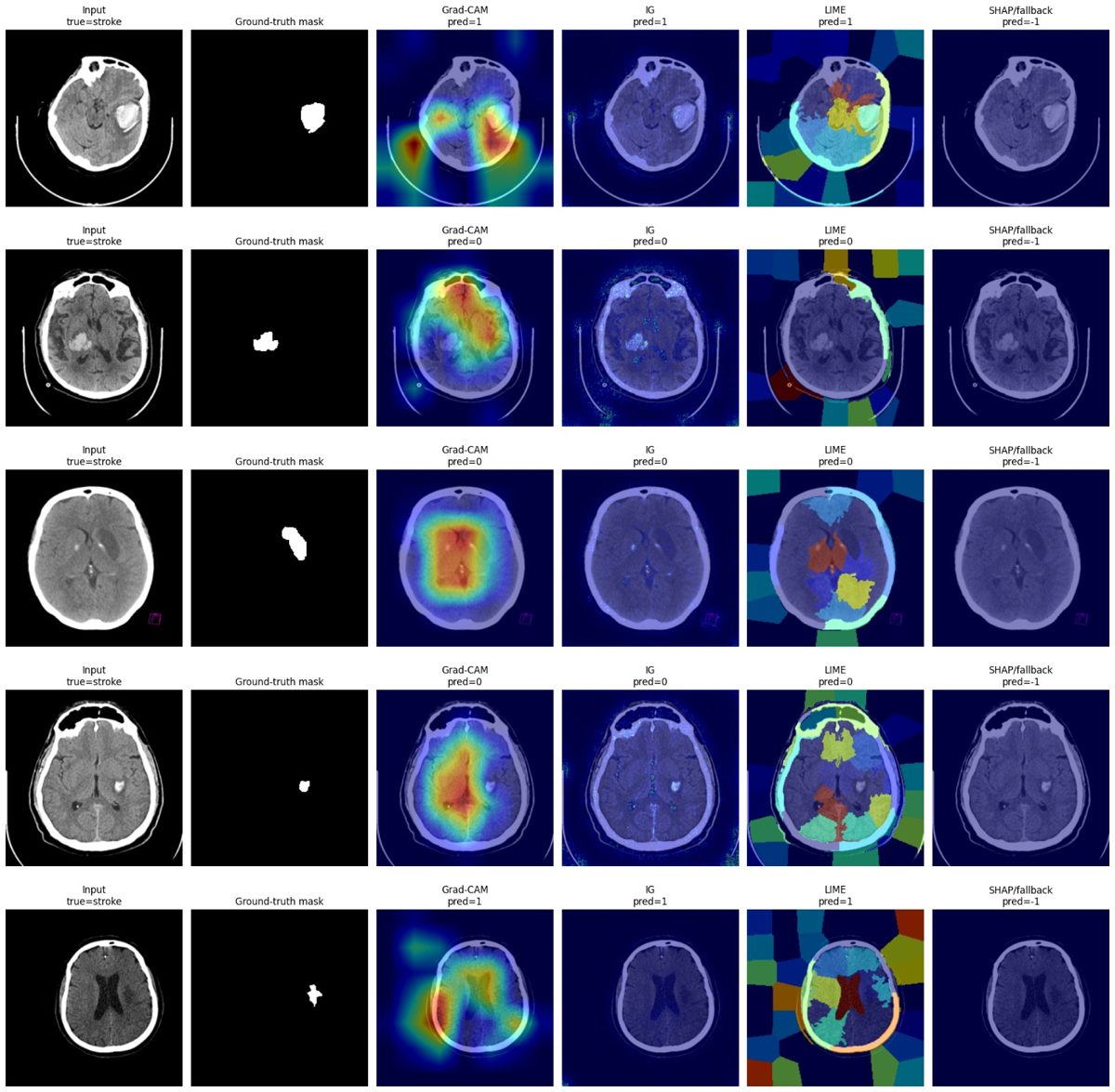 Sample explanation maps on five stroke-CT test cases: input slice, ground-truth lesion mask, and the four explanation methods